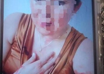 Autoridades se comprometen a dar seguimiento a caso de regidor golpeador.