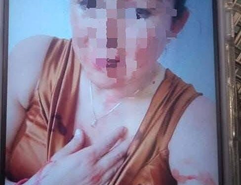 Autoridades se comprometen a dar seguimiento a caso de regidor golpeador.